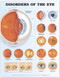 Disorders of the Eye 2nd Edition Anatomical Chart