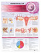 Infertility Anatomical Chart - 2nd Edition