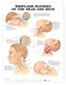 Whiplash Injuries of the Head and Neck Poster
