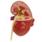 Kidney Model