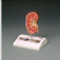 Kidney Stone Anatomical Model