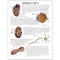 Diabetes Model Description Card