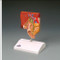 Gallbladder Gallstone Anatomical Model