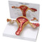 uterus Model