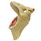 Shoulder Osteoarthritis Anatomical Model