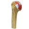 Shoulder Osteoarthritis Anatomical Model