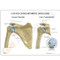 Shoulder Osteoarthritis Anatomical Model Description Card 