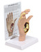 Hand Osteoarthritis Anatomical Model