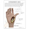 Hand Osteoarthritis Anatomical Model Description Card