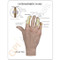 Hand Osteoarthritis Anatomical Model Description Card