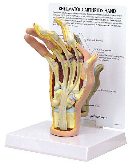 1931_RA_Hand__27752.1510529521