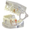 Jaw Model