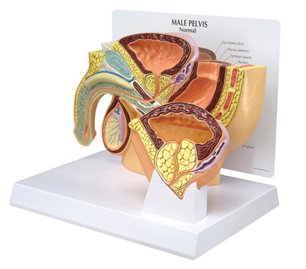 Male Pelvis With Benign Prostate Hyperplasia - Clinical Charts and Supplies