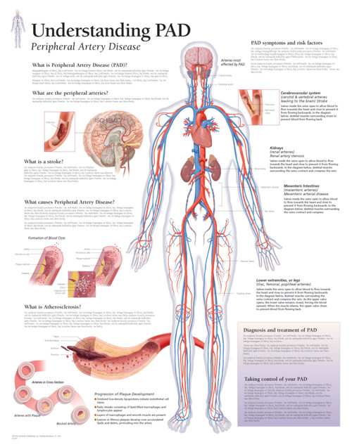 Peripheral Artery Disease ( PAD) Poster - Clinical Charts and Supplies