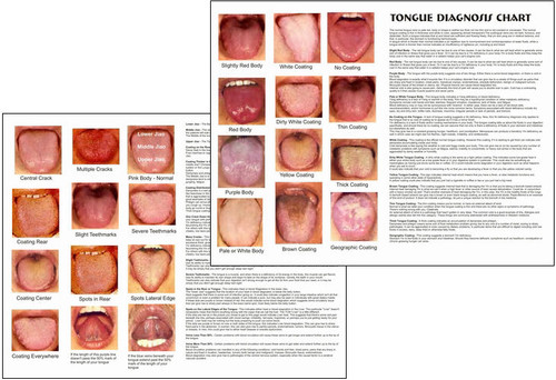 Tongue Diagnosis Chart