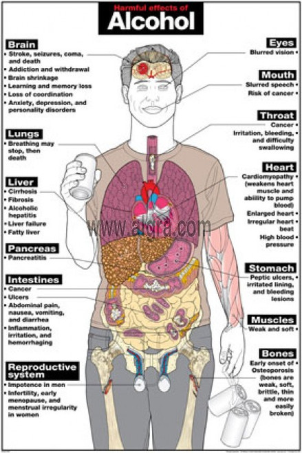 The Harmful Effects of Alcohol Poster - Clinical Charts and Supplies