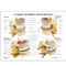 Four Stage Vertebrae  Disc Description Card