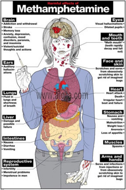 Harmful Effects of Methamphetamine Poster - Clinical Charts and Supplies