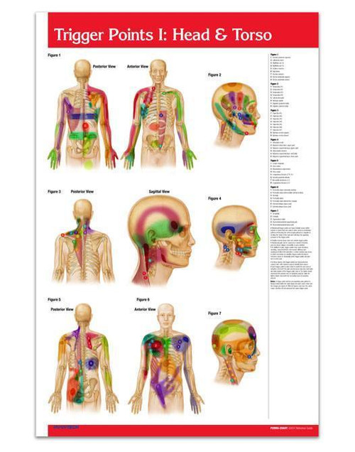 Trigger Points Head Torso And Extremities Poster Clinical Charts And Supplies