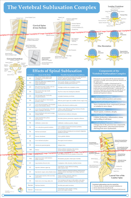 Vsc Vertebral Subluxation Complex Poster Clinical Charts And Supplies 4694