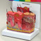 Skin Burn & Normal Skin Anatomical Model