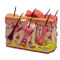 Skin Burn & Normal Skin Anatomical Model