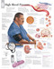 High Blood Pressure Anatomical Poster