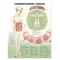 Understanding Cancer Anatomical Chart
