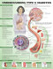 Understanding Diabetes 2 Diabetes