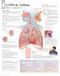 Asthma / COPD Anatomical Chart