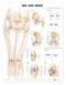 Hip and Knee Anatomical Chart -2nd Edition