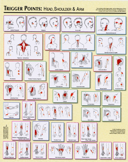 Trigger Point Charts Clinical Charts and Supplies