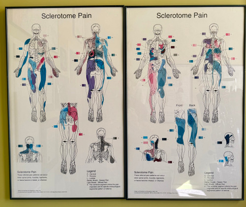 Sclerotome Pain 解剖図！カイロ！整体！鍼灸！エステ