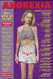 Anorexia Educational Chart