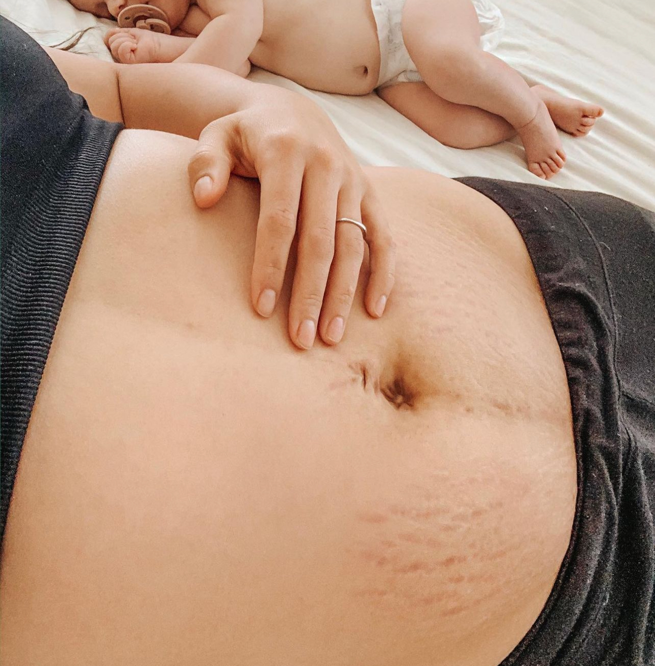 A close-up of a mom’s hand on her soft, stretchmarked postpartum belly. A sleeping baby lies next to her. 