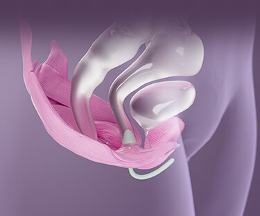 A woman lying down on dark plum-coloured bedding, seen from above. She is holding a phone up in one hand. Graphics of her pelvic floor muscles are superimposed over her pelvic area, with an Elvie trainer in the vaginal area of the graphic