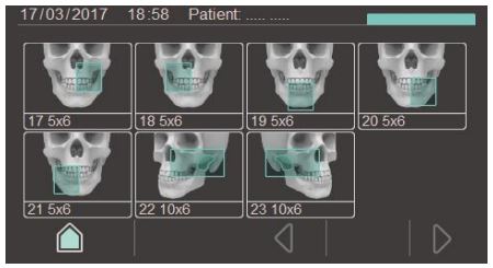 fona.ts.cbct3.jpg