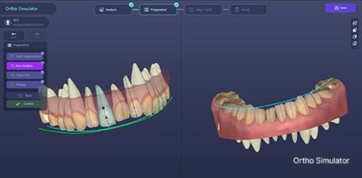 ortho-simulator.jpg