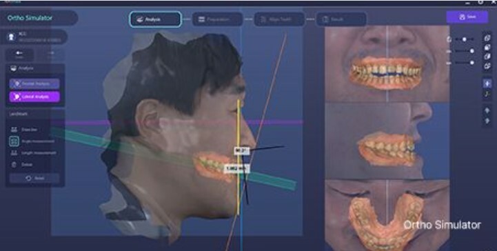 ortho-simulator2.jpg