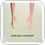 Spoon Kill The Moonlight Album Cover Sticker