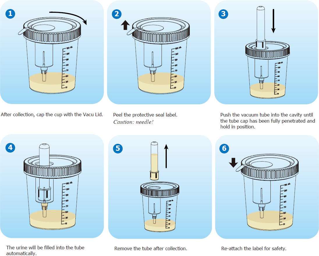 T-Cup Vacutainer Type Lid Instructions