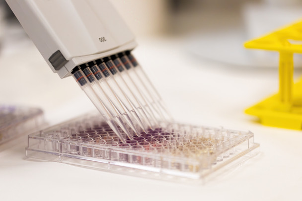 Surfactant Protein  ELISA