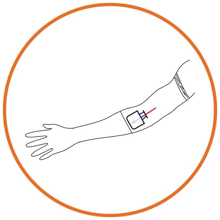 Clinically Proven PICC Sleeve, Line Securement by CareAline
