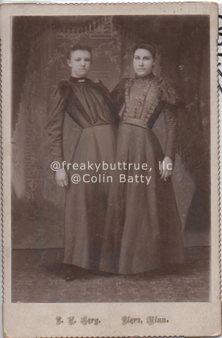 Original Cabinet Card - CC100 Conjoined Twin Women