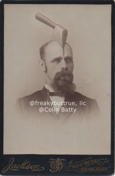 Original Cabinet Card - CC164 Hatchet in Guy's Head