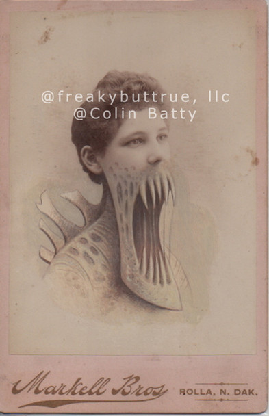 SOLD OUT Original Cabinet Card - CC219 Woman with Back Plates and Dislocated Jaw