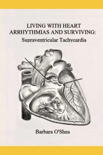 Living With Heart Arrhythmias And Surviving: Supraventricular Tachycardia