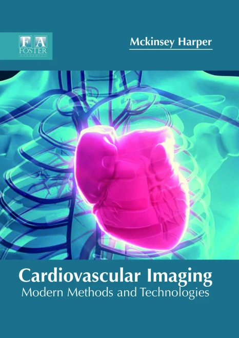 Cardiovascular Imaging: Modern Methods And Technologies