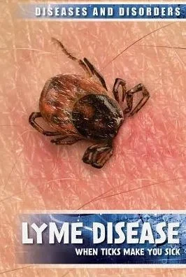 Lyme Disease: When Ticks Make You Sick (Diseases And Disorders)
