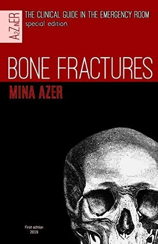 Bone Fractures: special edition of the clinical guide in the Emergency room. (A2ZinER)